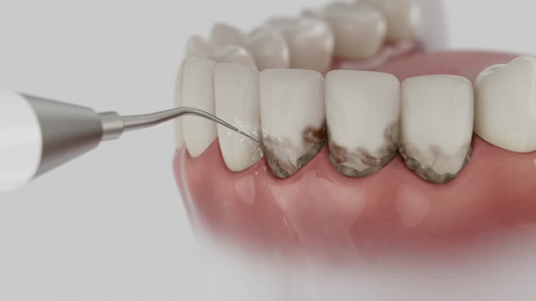 Reliable Wisdom Tooth Removal contractor in Dillingham Census Area County, AK by Dentist Open Now